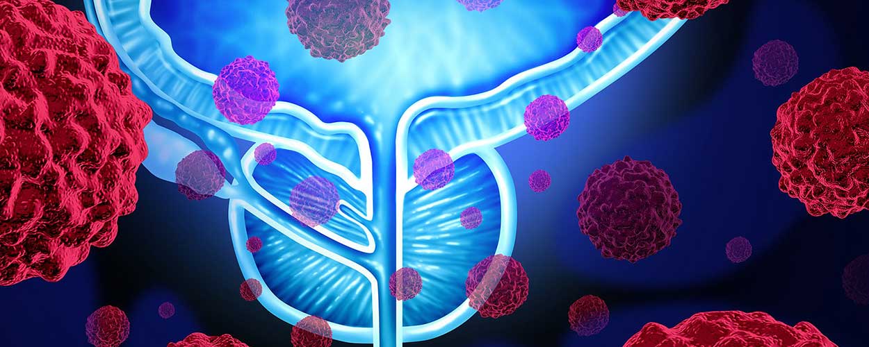 Bladder-Cancer.jpg
