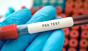 PSA Levels at 70? What Many Should Consider