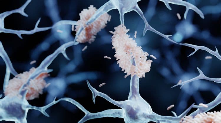 Guide to Lymphoma Treatment: Options, Side Effects, and Prognosis