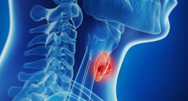 Drugs That May Cause B Cell Lymphoma and How to Treat It