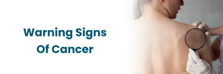 7 Signs of a Cancerous Lymph Node You Shouldn’t Ignore